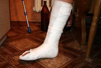 В Кировской области мужчина случайно сломал приятелю ногу