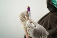 В Кировской области умер 149 пациент с коронавирусом