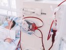 Больше 60 кировчан с COVID-19 получают диализную помощь