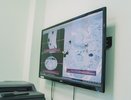 Онкологи удалили кировчанину опухоль весом около 6 кг