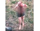 Известно состояние мужчины, который бегал с ножом в груди