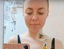 Наблюдала за процессом без наркоза: кировчанка рассказала о пересадке костного мозга