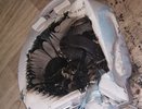 В Омутнинской ЦРБ во время пожара пострадала медсестра