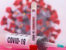 За сутки в Кировской области умерли несколько человек с коронавирусом