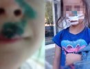 Хозяйку собаки, которая изуродовала ребенка в Омутнинске, заставят выплатить денежную компенсацию
