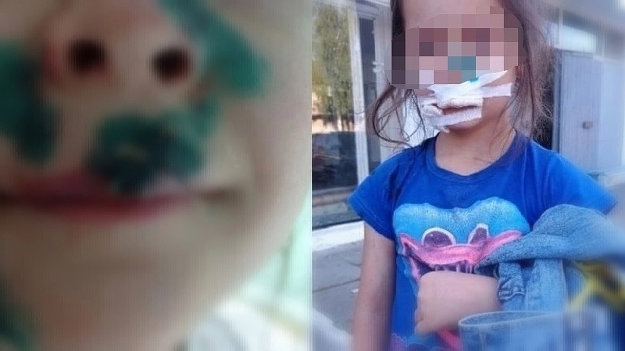 Главная картинка новости: Хозяйку собаки, которая изуродовала ребенка в Омутнинске, заставят выплатить денежную компенсацию
