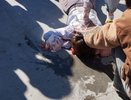 Следователи проводят проверку после травмирования ребенка в скейт-парке в Кирове