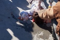 Следователи проводят проверку после травмирования ребенка в скейт-парке в Кирове
