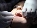 При потере зубов вероятность смерти возрастает на 66 %: ученые выяснили, с чем это связано