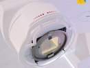 В Кировской области внедрили инновационный метод лечения рака