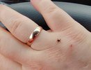 Половина чайной ложки в воду, и клещи будут обходить вас стороной: дорогие репелленты не нужны
