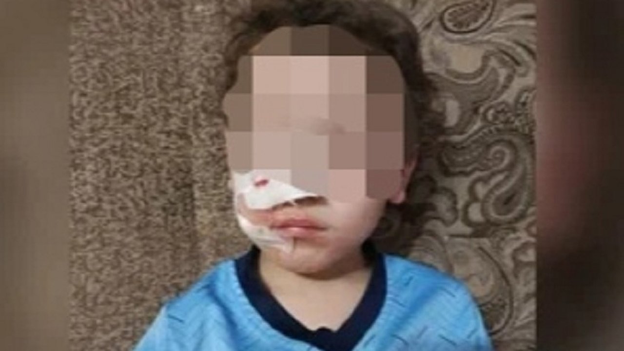 Главная картинка новости: В Яранске 7-летний мальчик, которого покусала собака, получит компенсацию