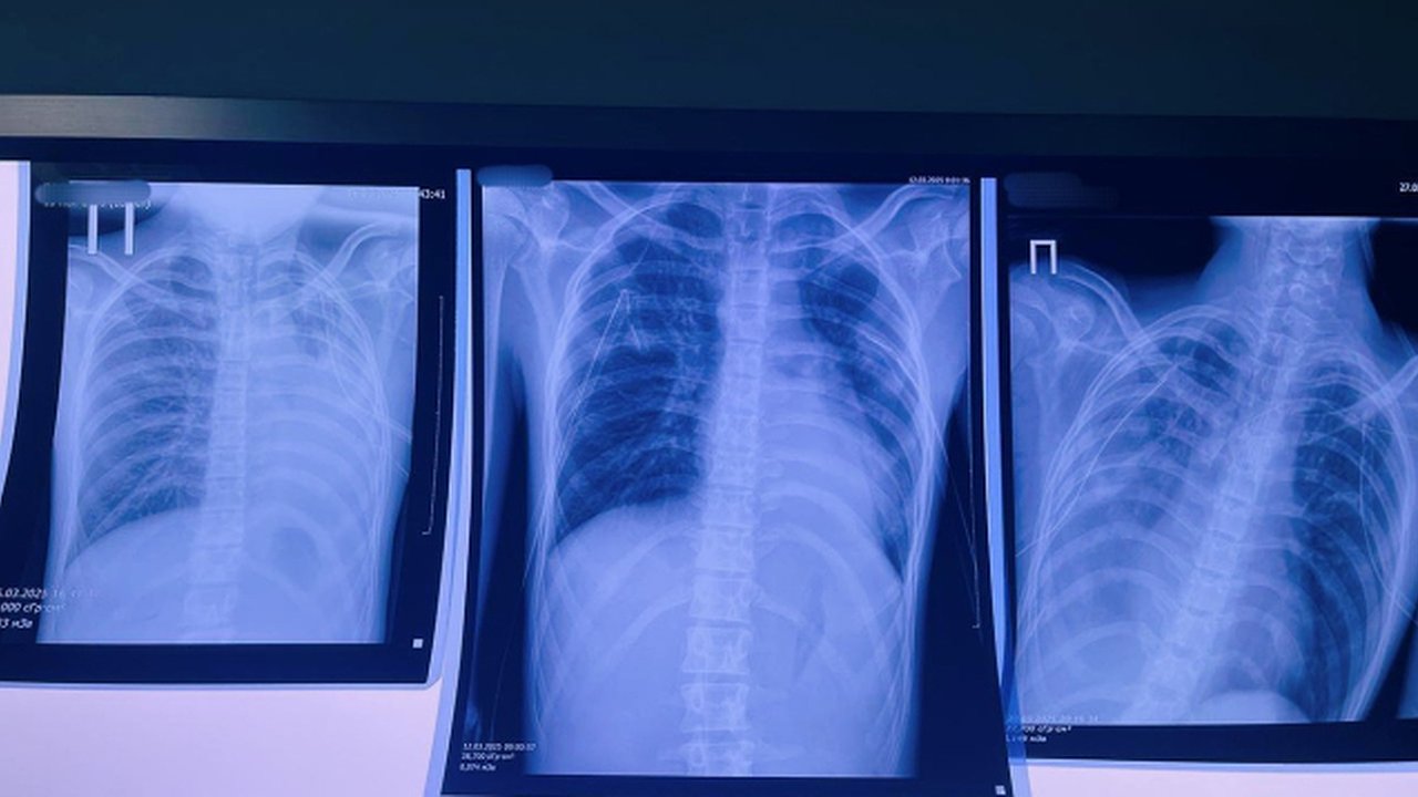 Главная картинка новости: В России хотят запретить вейпы после двух резонансных случаев с кировскими подростками