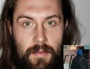 В Кировской области пропал нуждающийся в медицинской помощи мужчина
