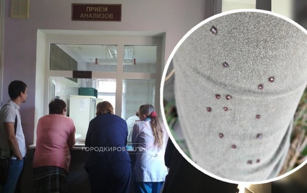 "И красные, и черные, и пятнистые": кировчанка за 5 минут прогулки сняла с себя 30 клещей