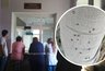 "И красные, и черные, и пятнистые": кировчанка за 5 минут прогулки сняла с себя 30 клещей