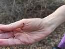 В Кировской области изменился порядок помощи при укусах клещей