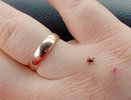 Весной капаю 2 капли на одежду для защиты от клещей: защищают 24 часа, а еще средство безопасно для детей