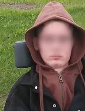 После укуса энцефалитного клеща чепецкий подросток впал в кому