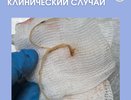 В Кирове ветеринары спасли курицу, у которой из-за паразитов застряло яйцо