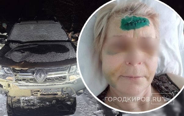 "Тащил ее без сознания за капюшон": пьяный кировчанин, сбивший женщину, отделался лишением прав