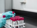 6 на ИВЛ. 62 новых случая COVID-19 за сутки в Кировской области