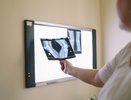 Кировские медики помогли ребёнку из Нижнего Новгорода с ювенильным ревматоидным артритом
