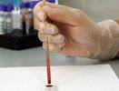 Известны новые данные по заразившимся COVID-19 в Кировской области