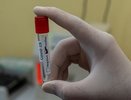 В Кировской области свыше 15 тысяч человек лечатся от COVID-19