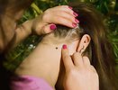 В Кировской области от укусов клещей пострадали более 23 тысяч человек