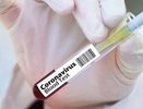 10 на ИВЛ и десятки заболевших: статистика по коронавирусу на 30 августа