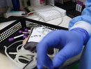 Известно, сколько платят за кровь переболевших коронавирусом в Кирове