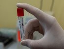 В Кировской области от ковида лечится свыше 17 тысяч пациентов