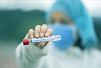 60 заболевших COVID-19 выявлено в Кировской области