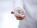 48 заболевших, 7 на ИВЛ: статистика по COVID-19 на 8 августа