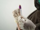 В Кировской области умер 149 пациент с коронавирусом